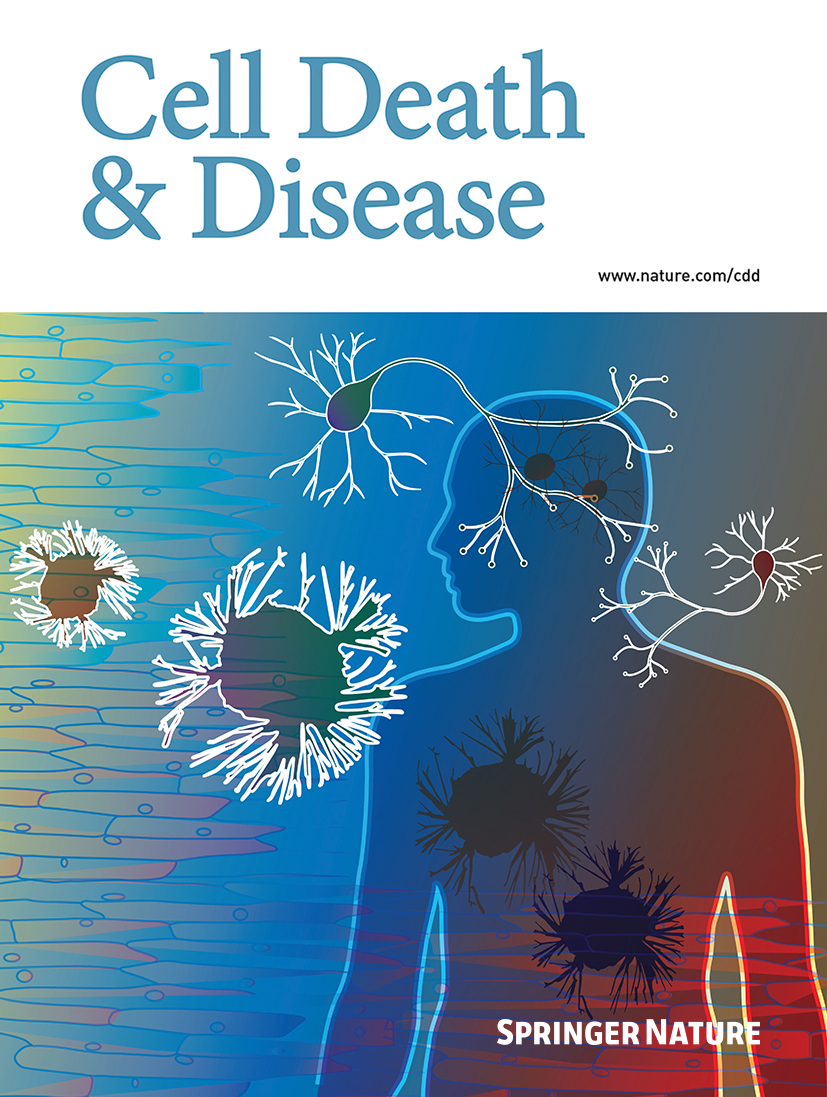 Nouvelle publication Cell Death & Disease - Nature press