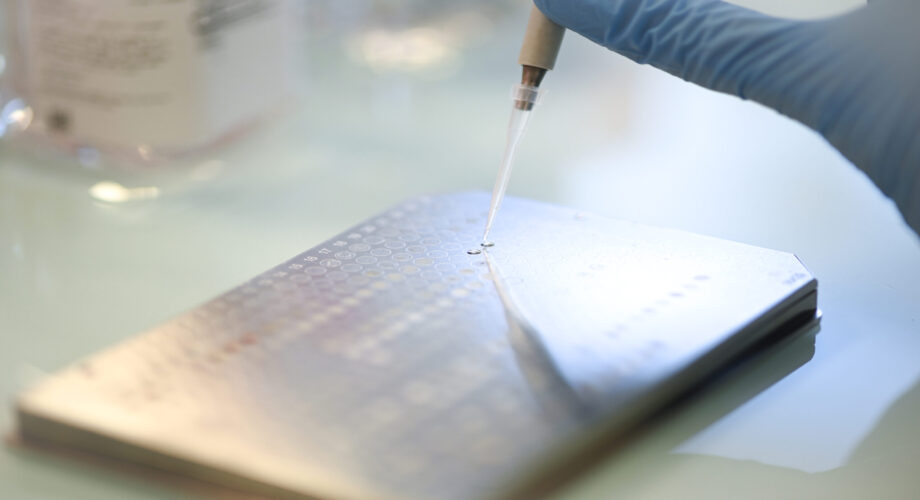 MALDI plate sample deposition in a MALDI-TOF plate