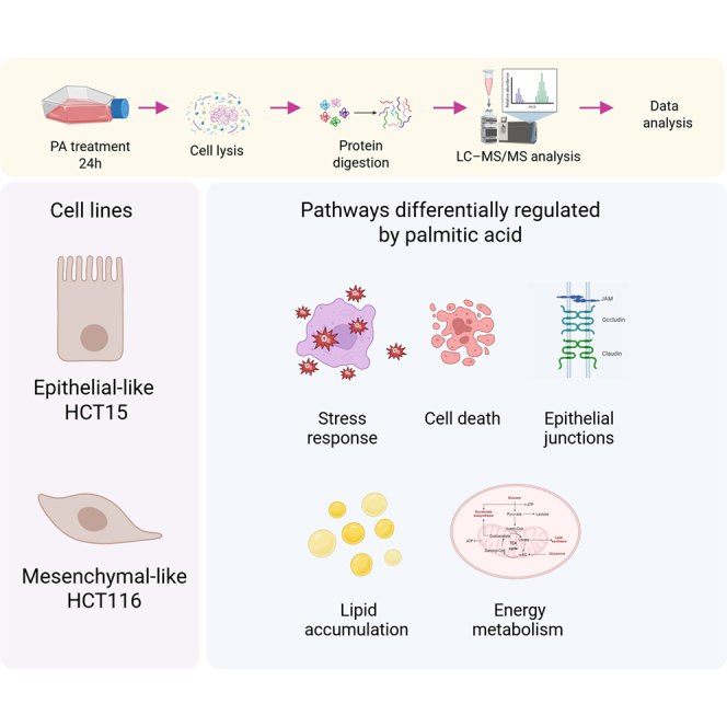 Epithelial-Mesenchymal Transition Shapes the Lipotoxic Response of Colon Cancer Cells to Palmitic Acid